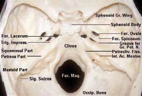Temporal Bone And Adjacent Cranial Base Neuroanatomy The