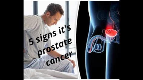 5 Signs Its Prostate Cancer Youtube