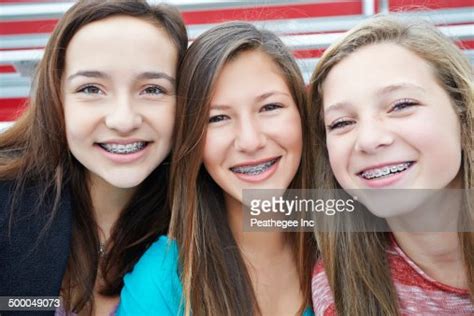 Teenage Girls Showing Off Braces Together Photo Getty Images