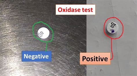 Oxidase Test For Bacteria Introduction Principle Procedure Result