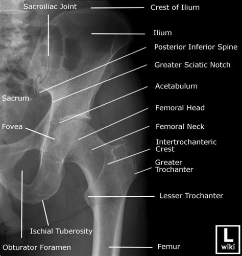 Pelvic Anatomy Xray Likes Comments The Radiologist