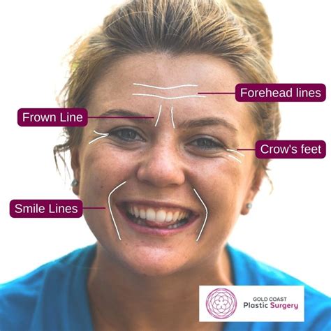 Frown Lines And Forehead Wrinkles Prevention And Treatment