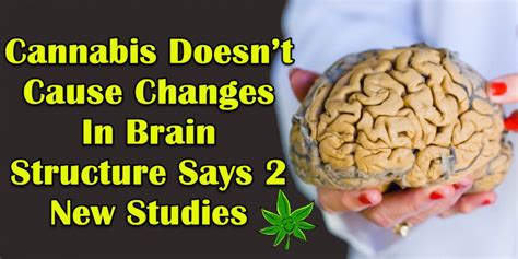 Cannabis Doesnt Cause Changes In Brain Structure Says 2 New Studies
