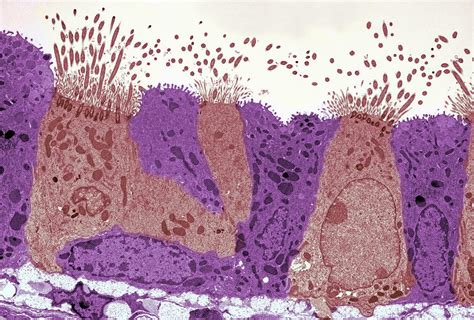 Lung Epithelial Layer Photograph By Science Stock Photography Pixels