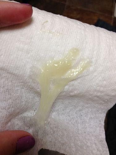 Yellow Cervical Mucus Pregnant Jualitapomsibe