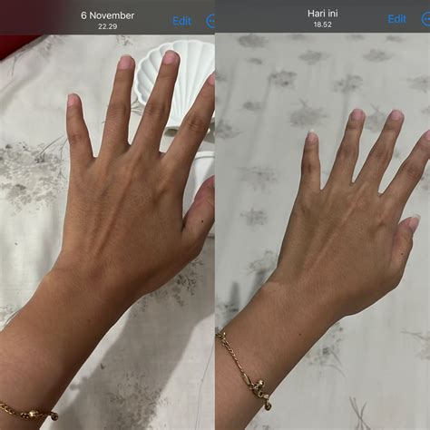 Cara Mengatasi Tangan Belang dengan Scarlett Whitening Body Serum 7X