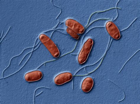 Legionella Pneumophila Scheda Batteriologica Ed Approfondimenti