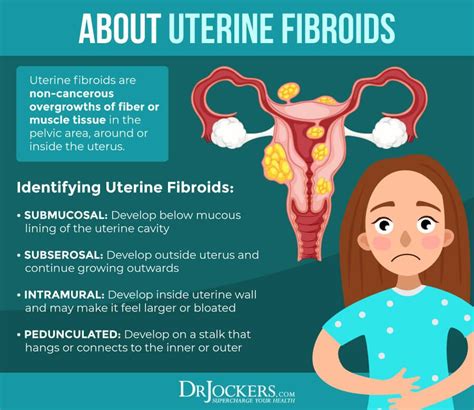Uterine Fibroids Symptoms Causes And Natural Support Strategies Artofit