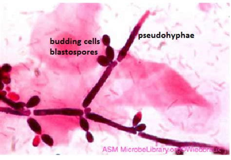 Microscopic Morphologic Features Of Yeast Medical Laboratories