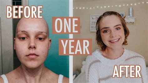 One Year Post Chemo Hair Growth Lauren Mae Youtube