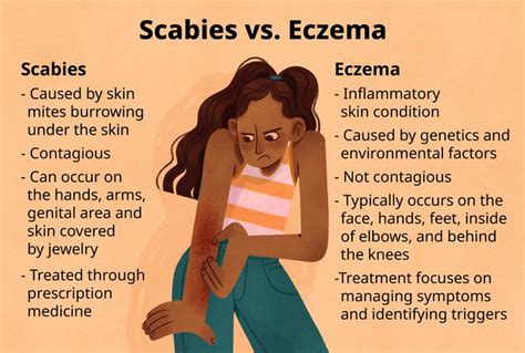 Scabies Vs Eczema Different Rashes And Treatments