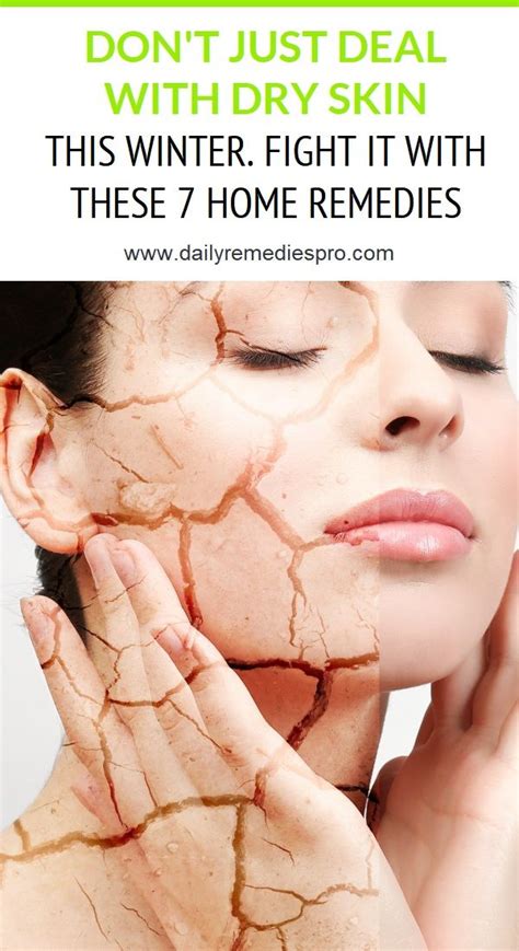 The Best Way To Deal With Dry Irritated Weepy Skin Heidi Salon