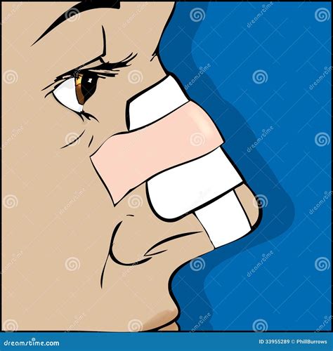 Broken Nose Royalty Free Stock Images Image 33955289
