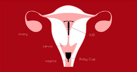 Can You Use A Menstrual Cup With An Iud Our Expert Guide