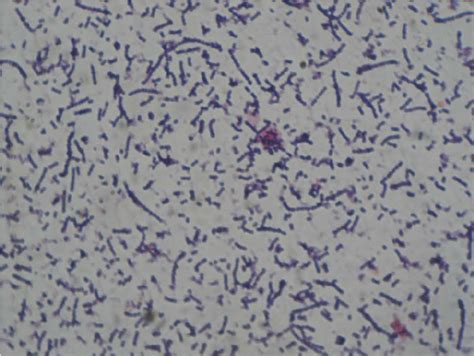 Grams Stain Of The Streptococcus Spp Showing Gram Positive Cocci In