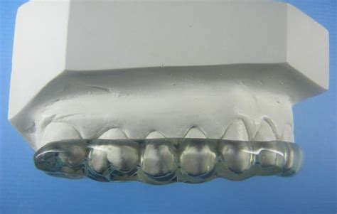 All Hard Splint Accutech Orthodontic Labs