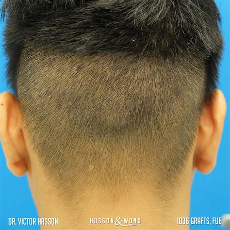 Here's how to know when it's really, truly time for a trim. HT Esteworld 3900 grafts op 11/09/17 - Pagina 2 - Haarweb ...