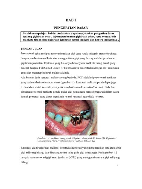 We did not find results for: Jenis-jenis Gigi Tiruan