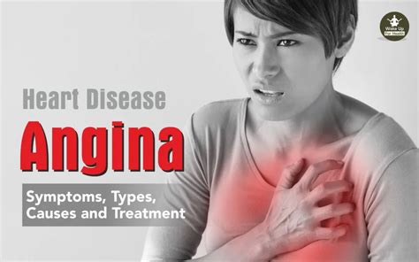 Angina Symptoms Causes Types Treatment Essentials Wfh
