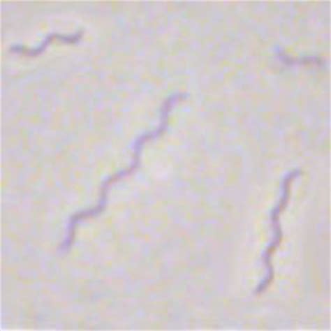 Rhodospirillum (bacteria púrpura, rhodospirillaceae), chlorobium ( bacteria verde del azufre , chlorobiaceae), heliobacterium ( bacteria gram positiva , heliobacteriaceae), Ch 19 Lab Bacteria - Mrs N. Nelson's Science Website