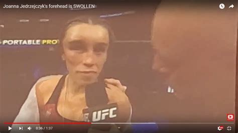 Joanna Jedrzejczyk S Forehead Is Unrecognizable After Fighting Zhang
