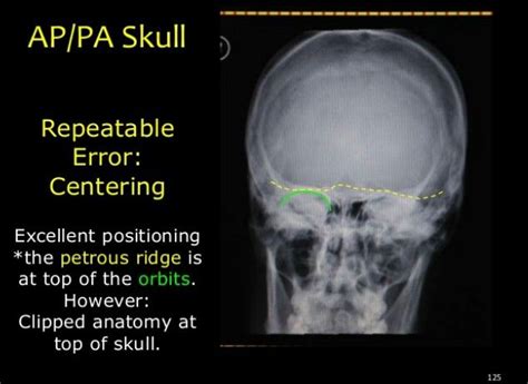 Uncategorized / x ray digital. AP/PA skull (With images) | Diagnostic imaging, Radiology ...