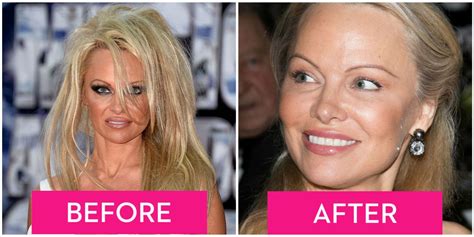 Pamela Anderson Got A Major Makeunder Baywatch Actress Looks Totally
