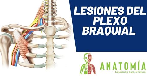 Brazo Del Plexo Braquial Lesiones Del Nervio Etiquetado Ilustraciones