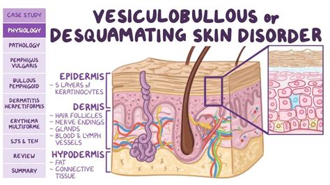 Vesiculobullous And Desquamating Skin Disorders Pathology Review Osmosis