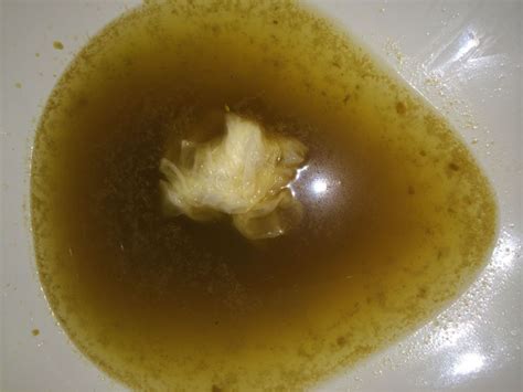Amazing Bile In Stool Yellow In The World Learn More Here Stoolz