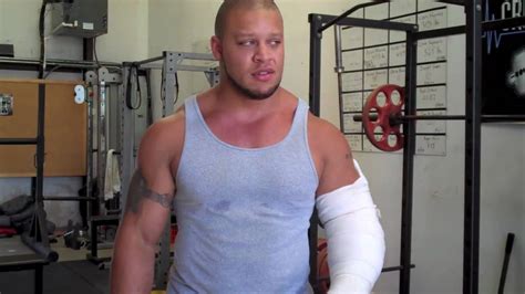 Elliott Hulses Torn Biceps Surgery And Recovery Journal Part 3 Youtube