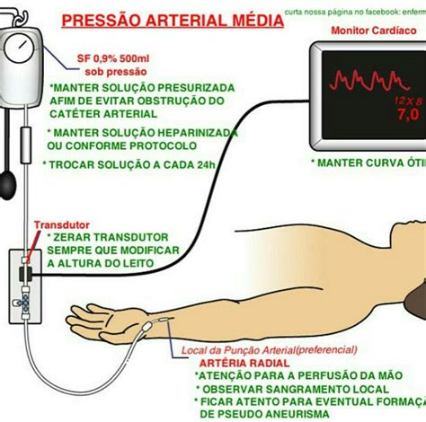 Pressão Arterial Não Invasiva