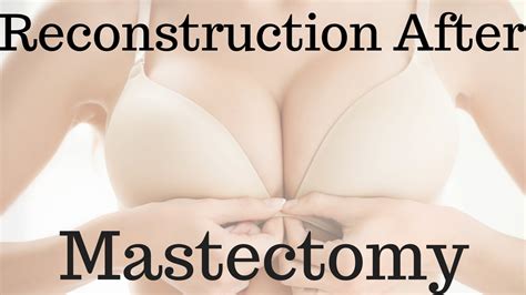 Reconstruction After Mastectomy YouTube