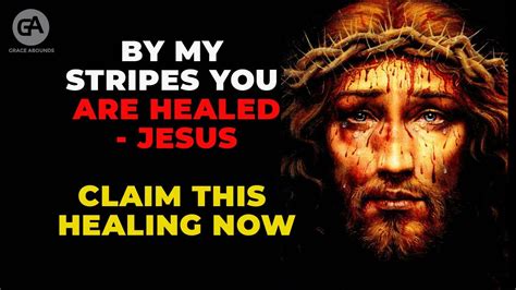Jesus Says By His Stripes You Are Healed Of All Diseases Claim This Healing Prayer To Jesus