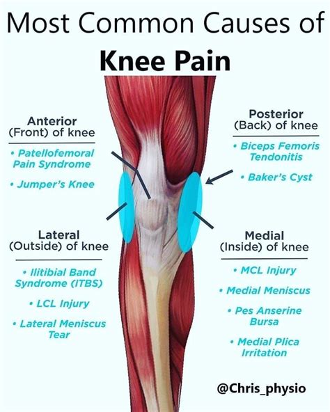 Lateral Posterior Knee Pain Fingersandfeathersh