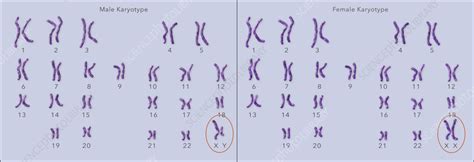 Normal Female And Male Karyotype Illustration Stock Image C0555514 Science Photo Library