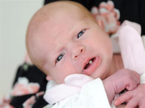 New Mum Stunned After Baby Girl Is Born With Fully Grown Tooth Herald Sun