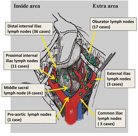 Inguinal Lymph Node Anatomy Images
