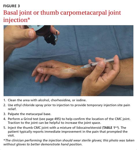 Carpal Metacarpal Joint Injection