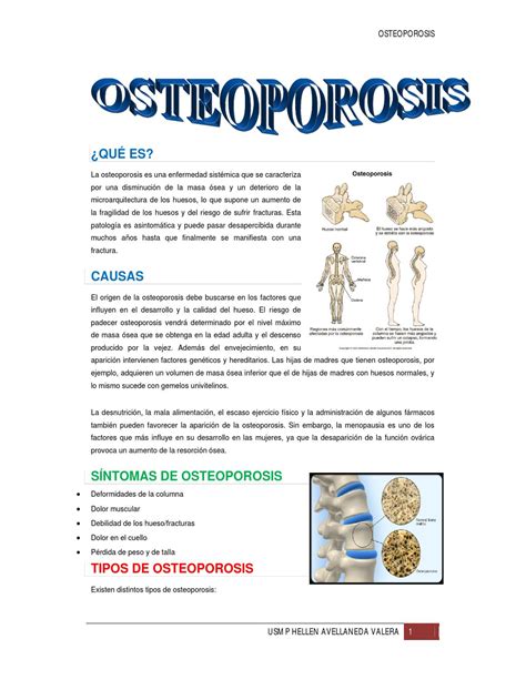 Osteoporosis By Hellen Avellaneda Issuu