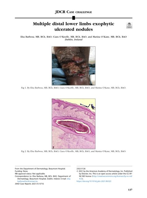 Pdf Multiple Distal Lower Limbs Exophytic Ulcerated Nodules