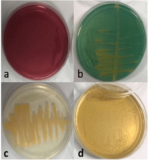 The Culturing Of Staphylococcus Aureus On A MacConkey Agar Media B