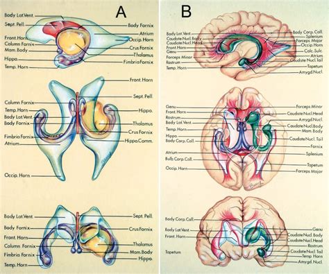Lateral And Third Ventricles The Neurosurgical Atlas