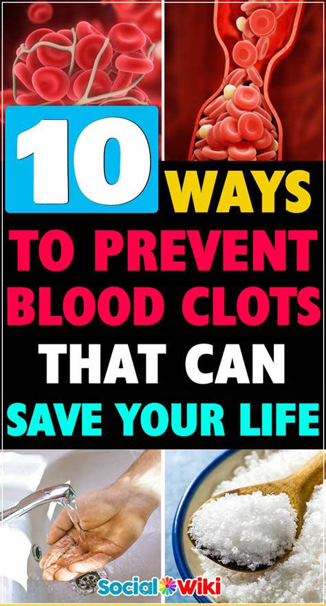 10 Ways To Prevent Blood Clots That Can Save Your Life Social Useful