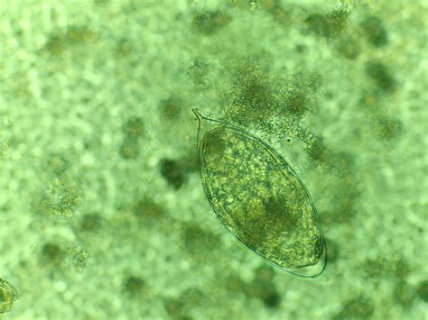 Intestinal Parasites Schistosomiasis Lstm
