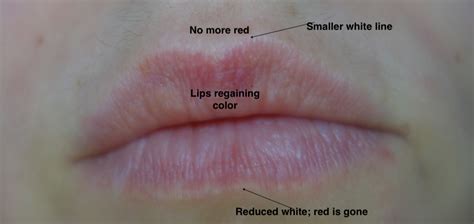 Why Do I Get Pale Lips Lipstutorial Org