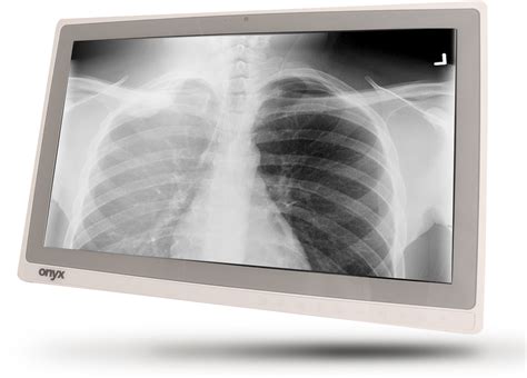 X Ray Png Transparent Images Png All