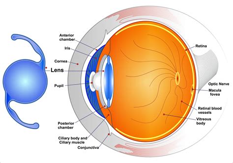 Light Adjustable Lenses Vs Traditional Intraocular Lenses