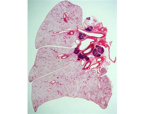 Right Lung Coronal Microanatomy Quiz