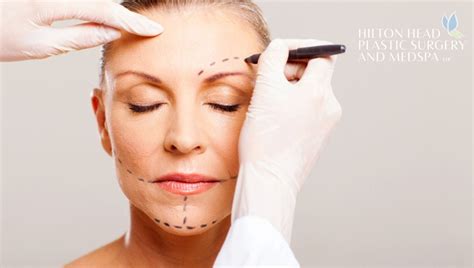 Top Reasons To Consider Lowcountry Plastic Surgery By Hilton Head